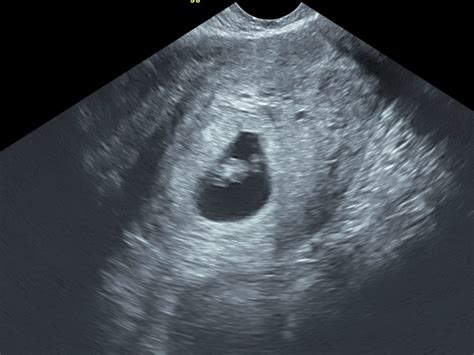 dating pregnancy scan near me